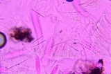 Lophodermium schweinitzii image