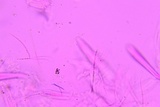 Lophodermium schweinitzii image