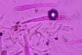 Lophodermium schweinitzii image