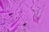 Lophodermium schweinitzii image