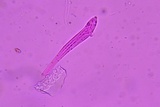 Lophodermium schweinitzii image