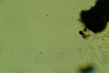 Anteaglonium globosum image