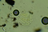 Anteaglonium globosum image