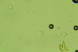 Hyphodermella rosae image
