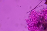 Hyphodermella rosae image