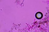 Hyphodermella rosae image