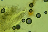 Hyphodermella rosae image