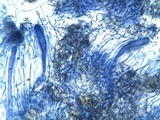 Phlyctis agelaea image
