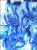 Phlyctis agelaea image