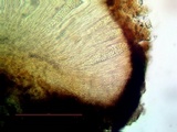 Sarcogyne similis image