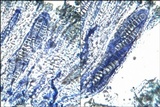 Phaeographis dendritica image