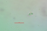 Candelariella aurella image
