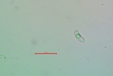Candelariella aurella image