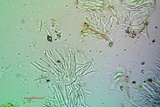 Candelariella aurella image