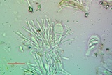 Candelariella aurella image