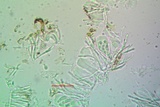 Candelariella aurella image