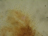 Unguiculariopsis parasitica image