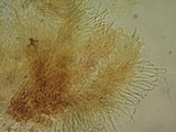 Unguiculariopsis parasitica image