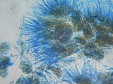 Unguiculariopsis parasitica image