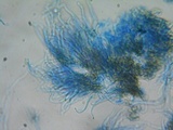 Unguiculariopsis parasitica image