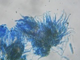 Unguiculariopsis parasitica image