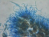 Unguiculariopsis parasitica image