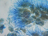 Unguiculariopsis parasitica image