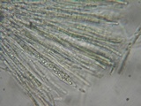 Dencoeliopsis johnstonii image