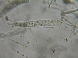 Dencoeliopsis johnstonii image