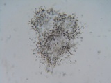 Eutypa flavovirens image