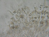 Eutypa flavovirens image