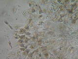 Eutypa flavovirens image