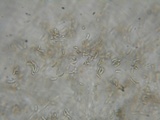 Eutypa flavovirens image