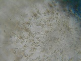 Eutypa flavovirens image