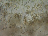 Eutypa flavovirens image