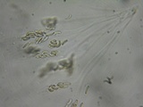 Eutypa flavovirens image