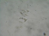 Eutypa flavovirens image