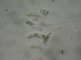 Eutypa flavovirens image