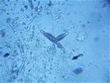 Pleomassaria siparia image