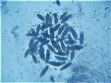 Pleomassaria siparia image