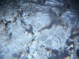 Lasallia pustulata image