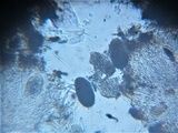 Lasallia pustulata image