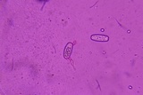 Sarcoscypha austriaca image
