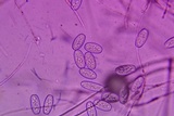 Sarcoscypha austriaca image