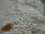 Lasiosphaeria strigosa image