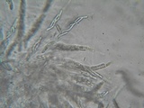 Lasiosphaeria strigosa image