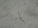 Lasiosphaeria strigosa image