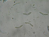Lasiosphaeria strigosa image
