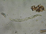Lasiosphaeria strigosa image