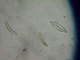 Lasiosphaeria strigosa image